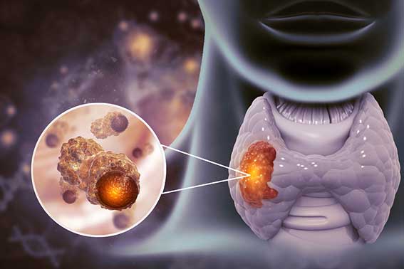 Medical Treatment